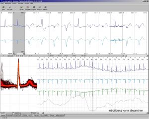 CardioDay V2.6 Langzeit-EKG